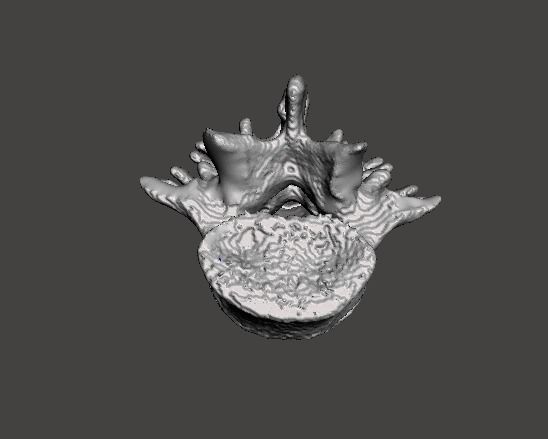 Lumbar Spine - male 3D model_7