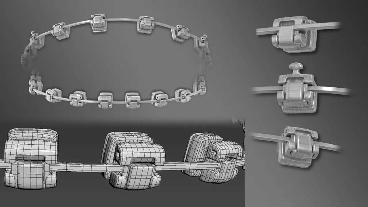 Dental Braces Low-poly 3D model