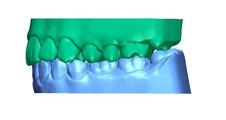Human Teeth with Base -  3D print model_4