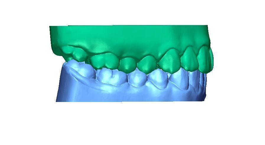 Human Teeth with Base -  3D print model_3