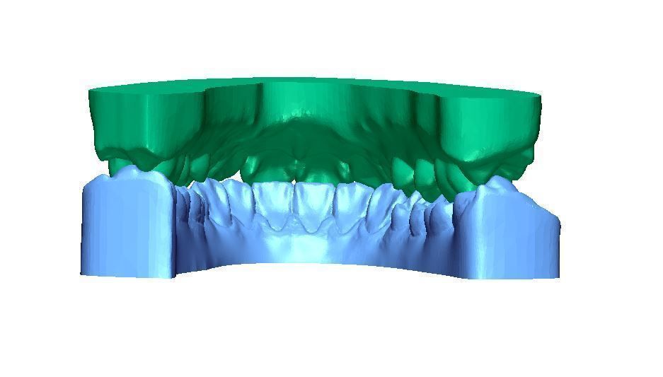 Human Teeth with Base -  3D print model_9