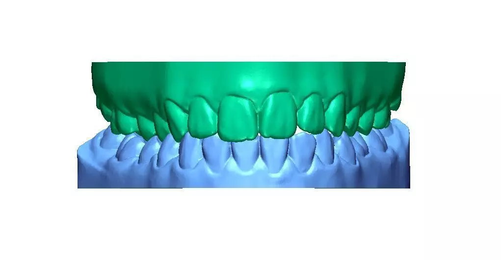 Human Teeth with Base -  3D print model_0