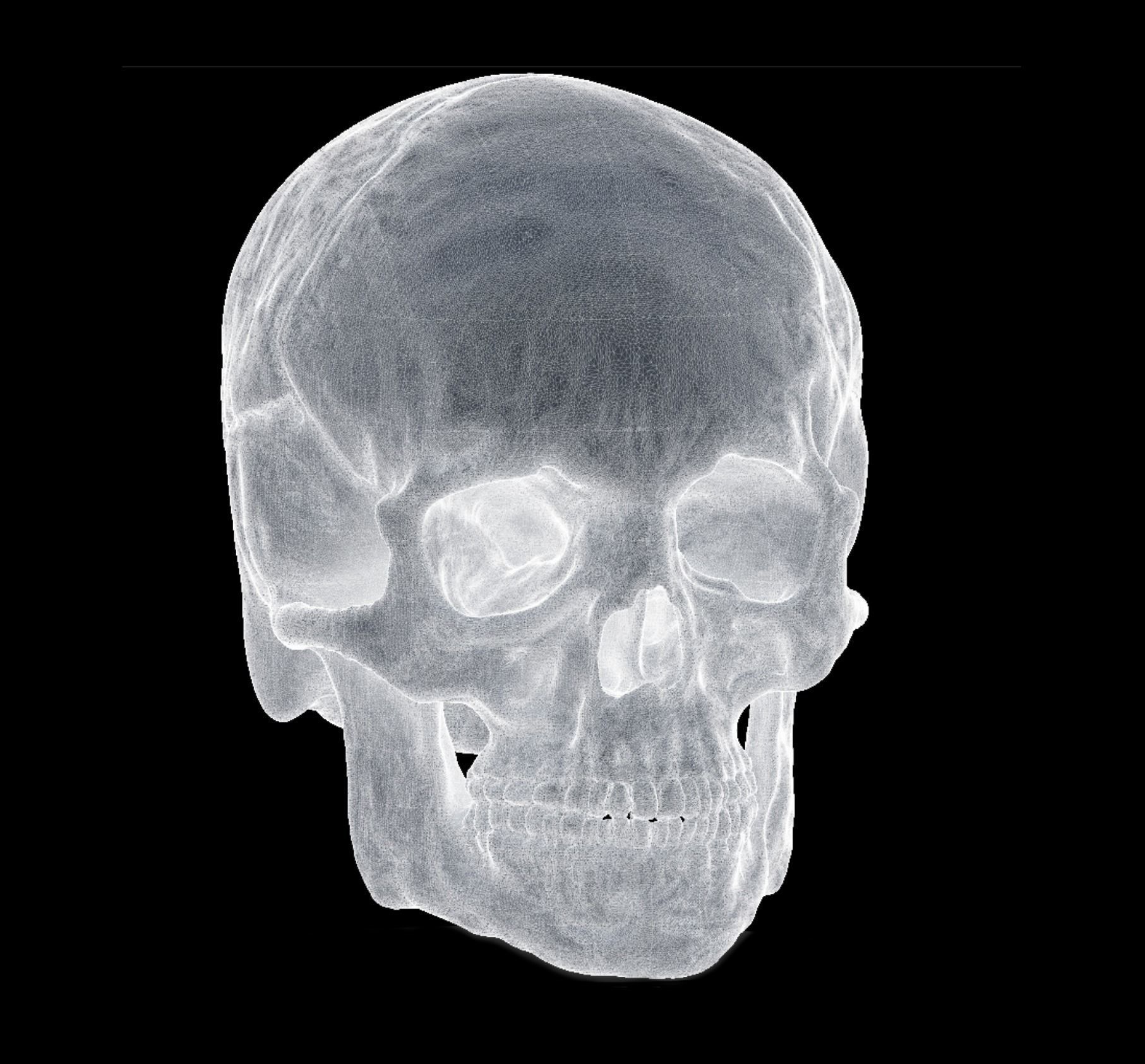Human Skull 3D print model_4