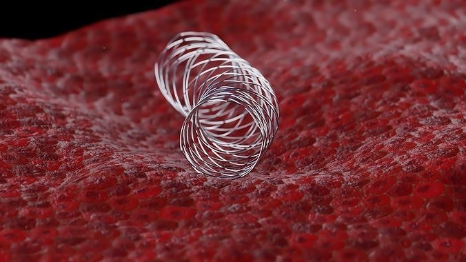 Nitinol  medical stent 3D model