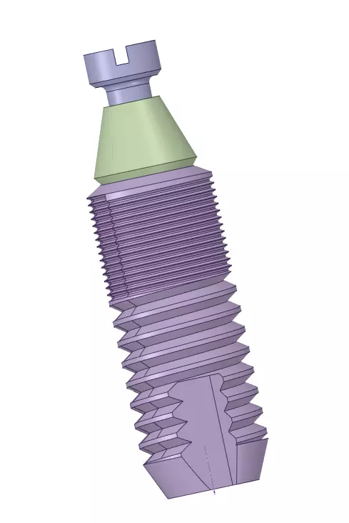 dental implants ready to FEA 3D model_0