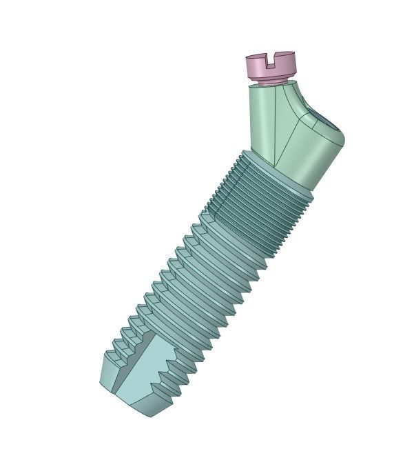 dental implants ready to FEA 3D model_3
