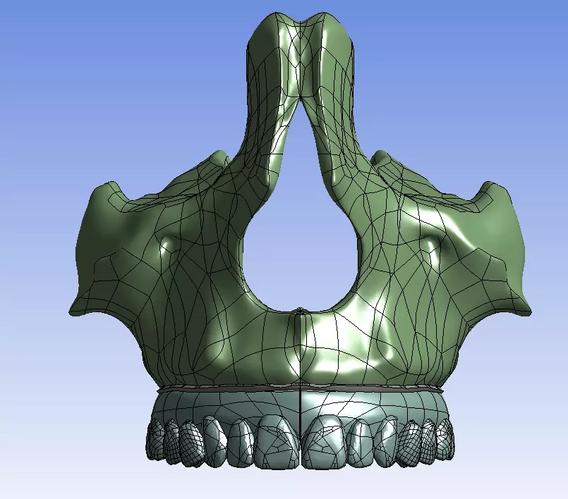 maxilla all-on-four 3D model
