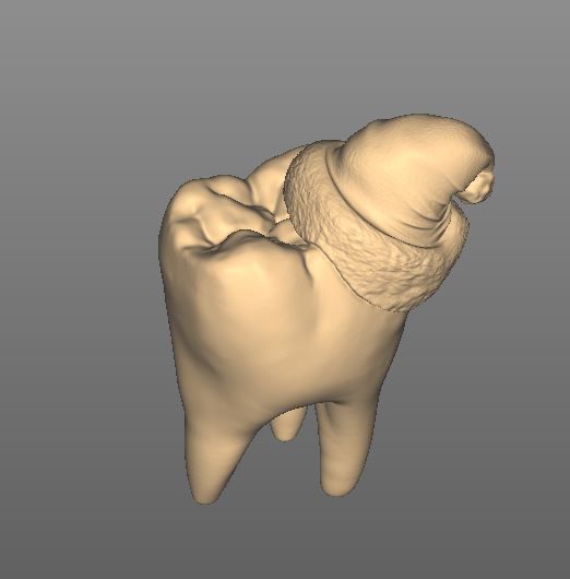 Dental Christmas Tooth  3D model_1