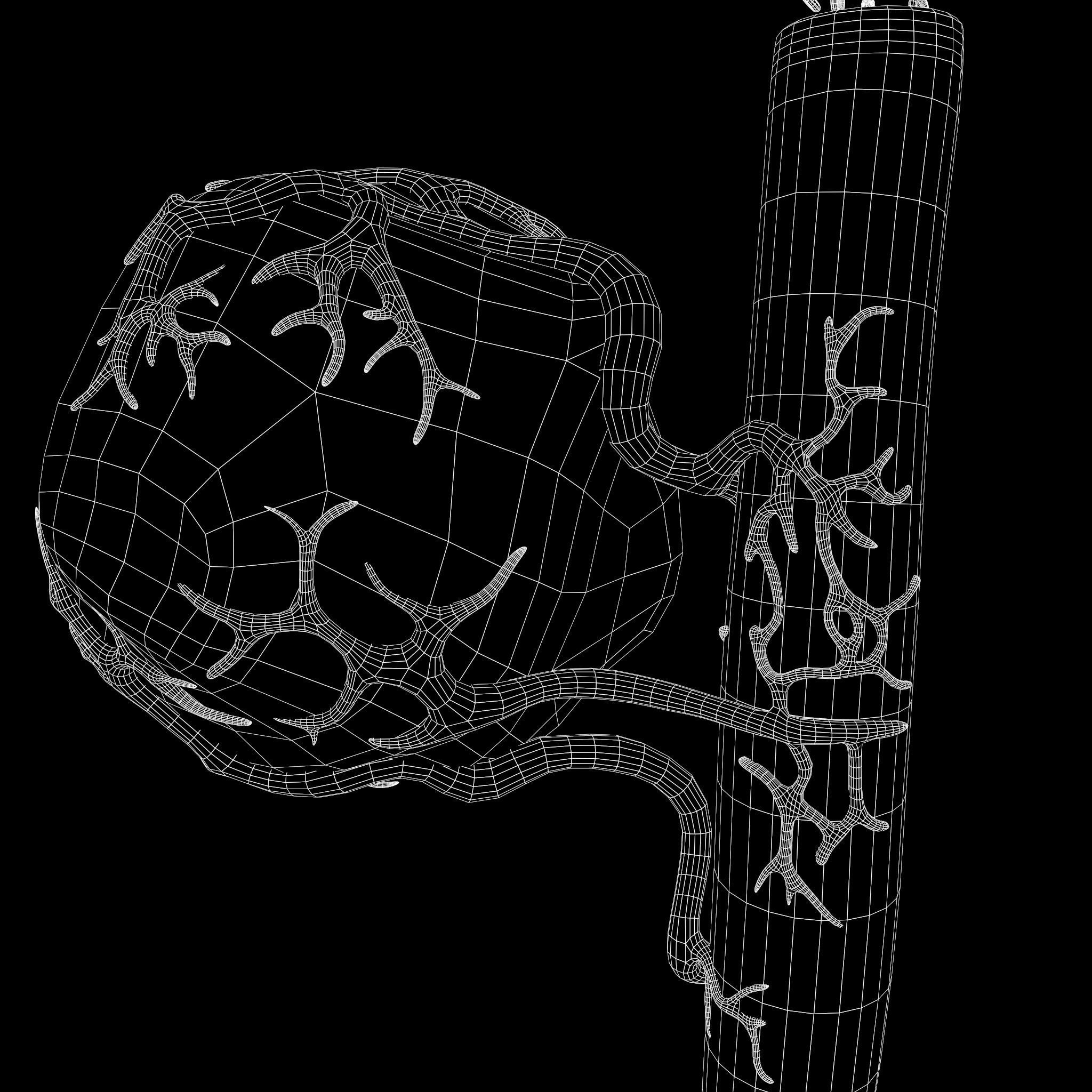Tumor with Vessels Low-poly 3D model_9