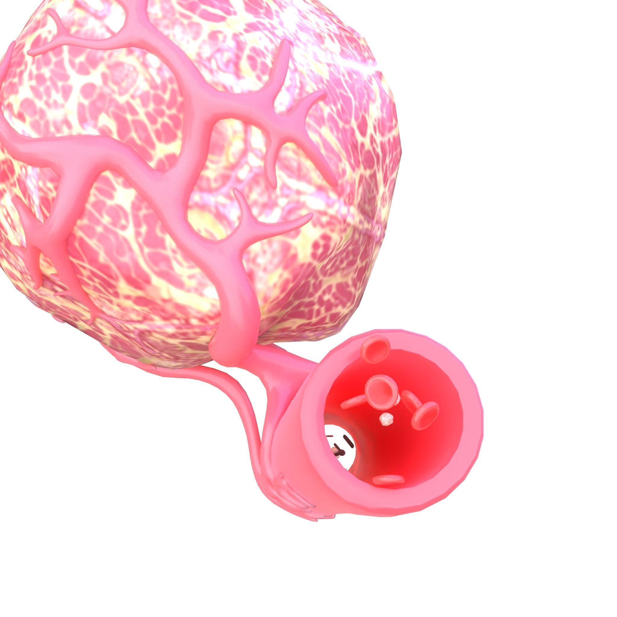 Tumor with Vessels Low-poly 3D model_6