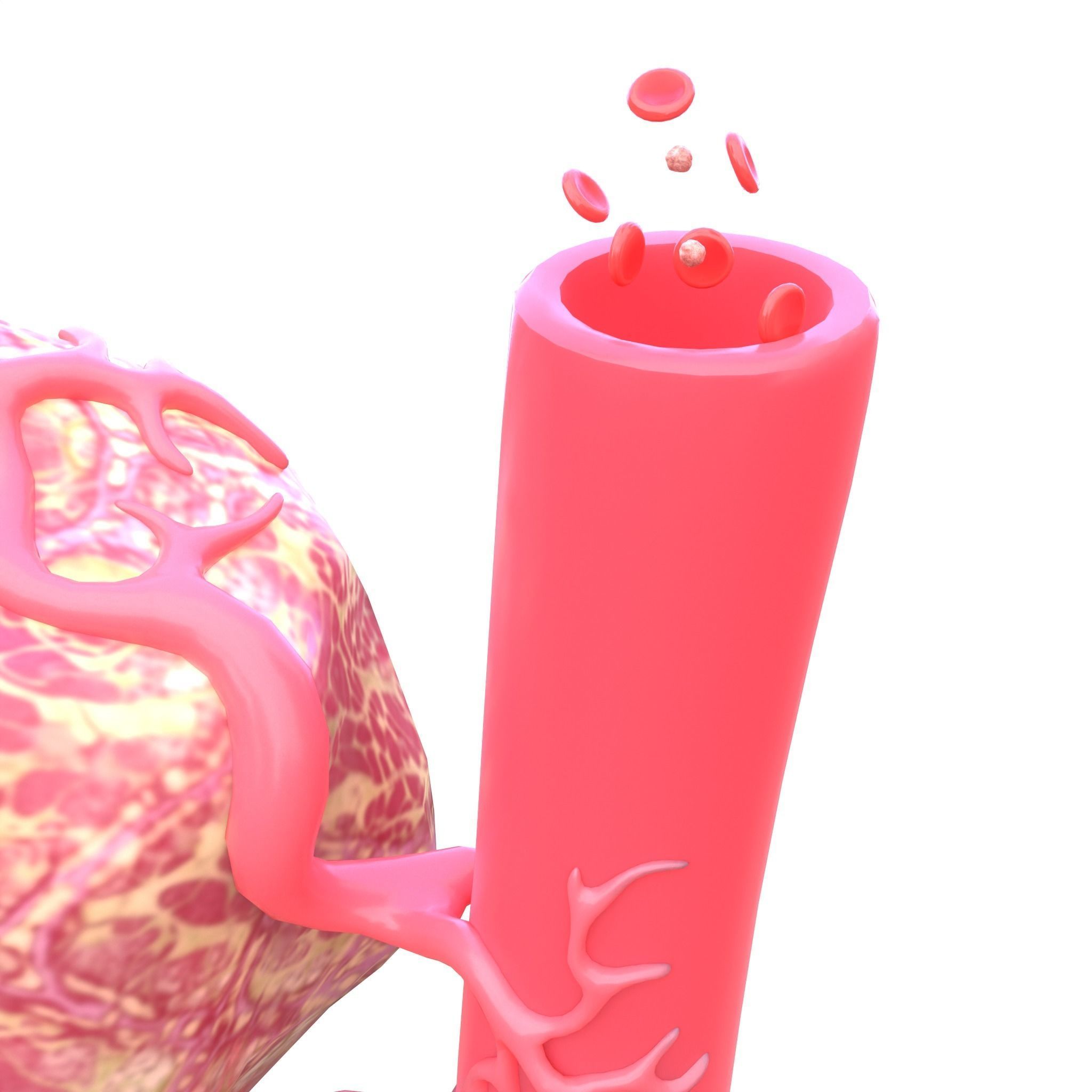 Tumor with Vessels Low-poly 3D model_7