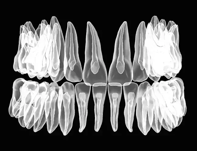 Maxillary and Mandibular teeth with pulp 3D print model