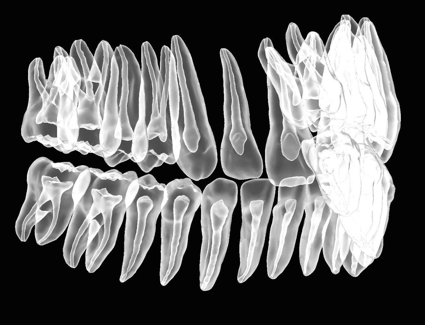Maxillary and Mandibular teeth with pulp 3D print model_1