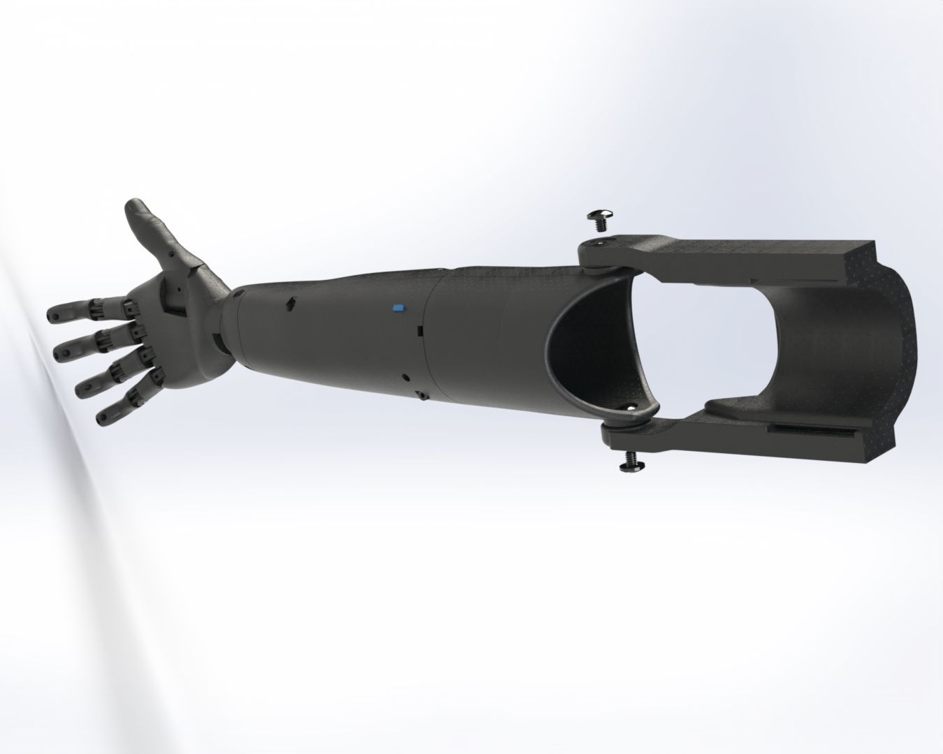 prosthesis arm 3D print model_1