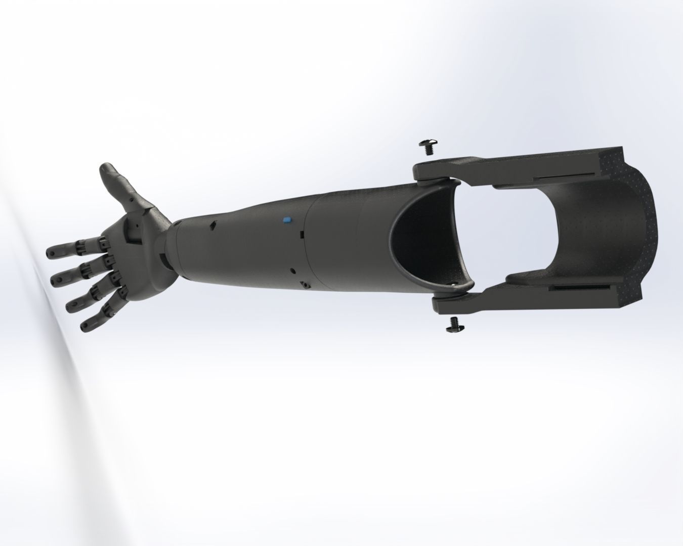 prosthesis arm 3D print model_2