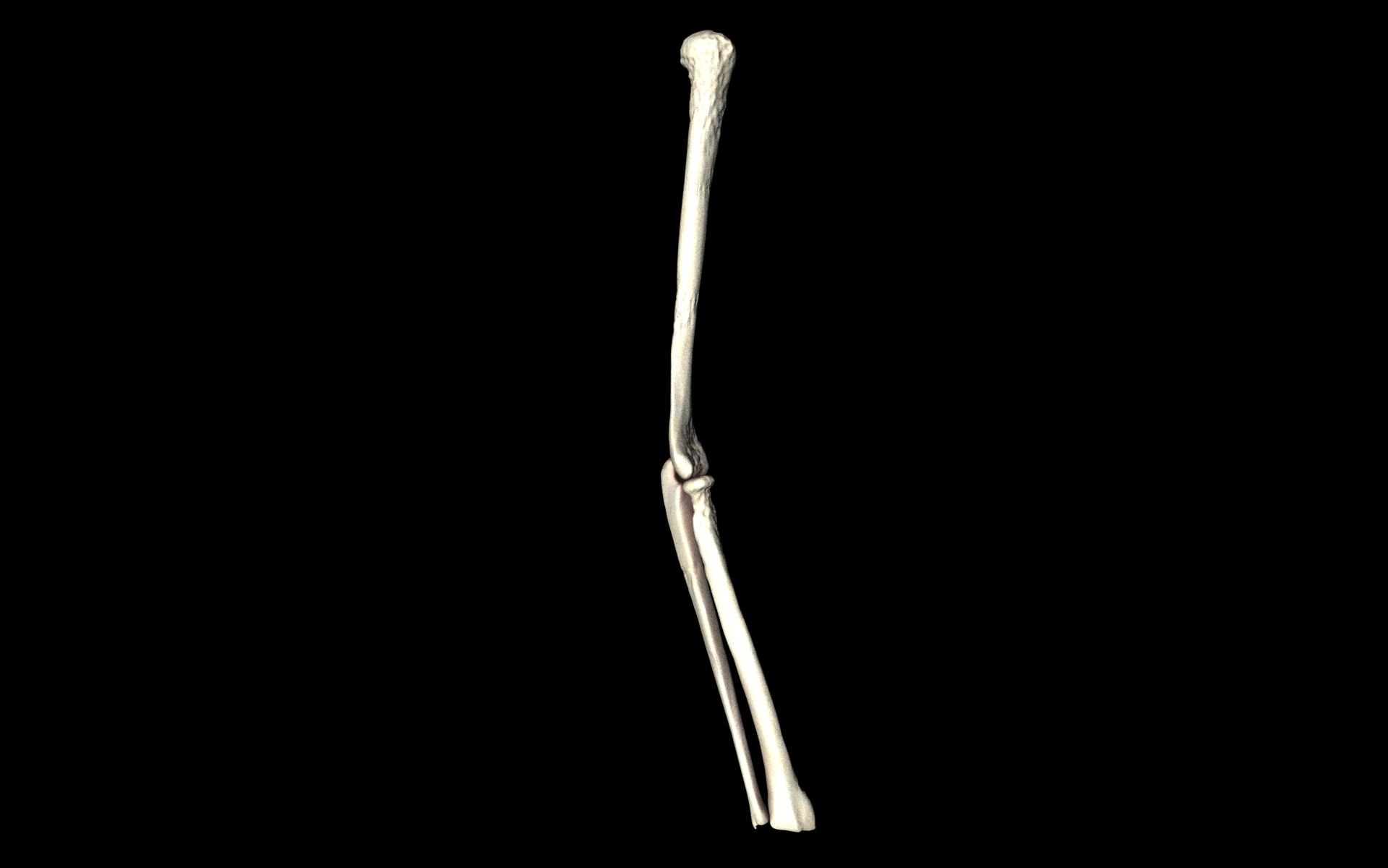 Elbow Joint Bones Humerus Radius Ulna - Medically Accurate 3d... 3D model_6