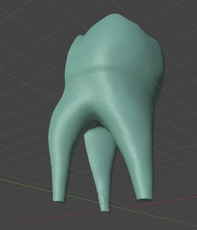 Molar Tooth -  Anatomical cross section 3D print model_8