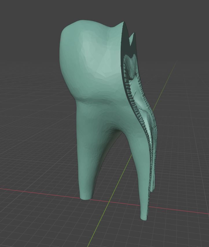 Molar Tooth -  Anatomical cross section 3D print model_4