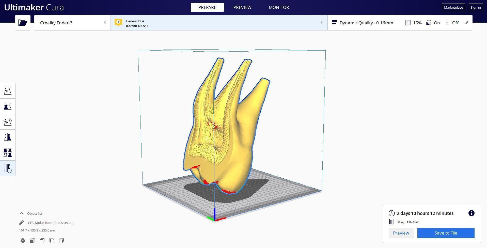 Molar Tooth -  Anatomical cross section 3D print model_9