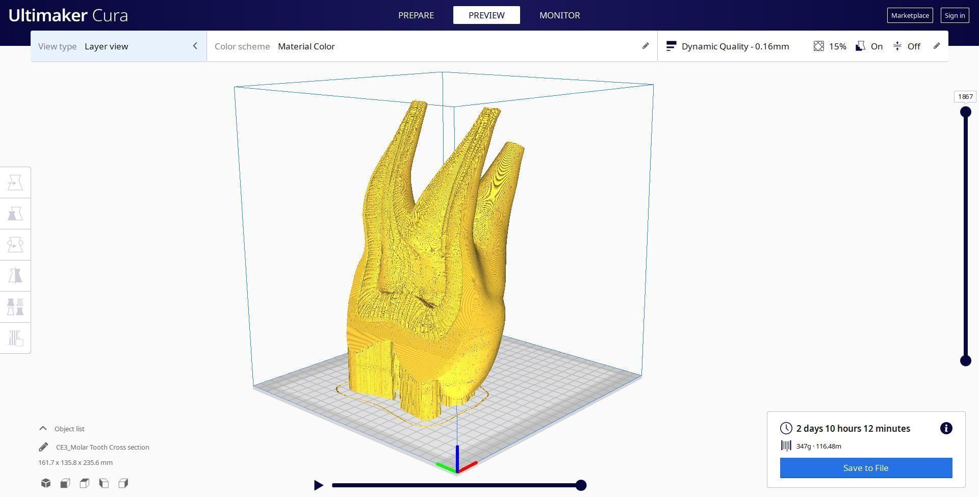 Molar Tooth -  Anatomical cross section 3D print model_10