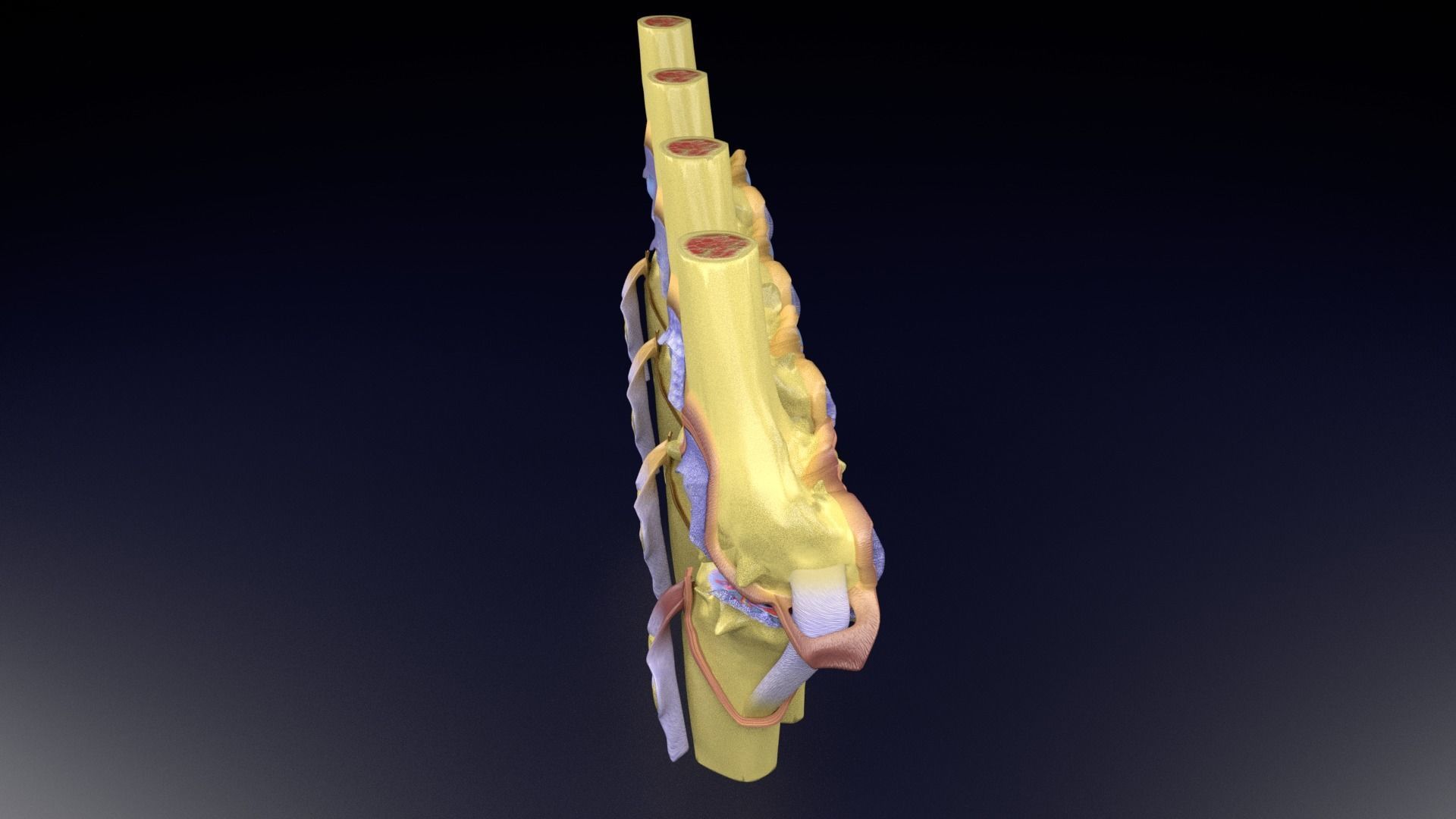 Osteoarthritis stages 3D model_74