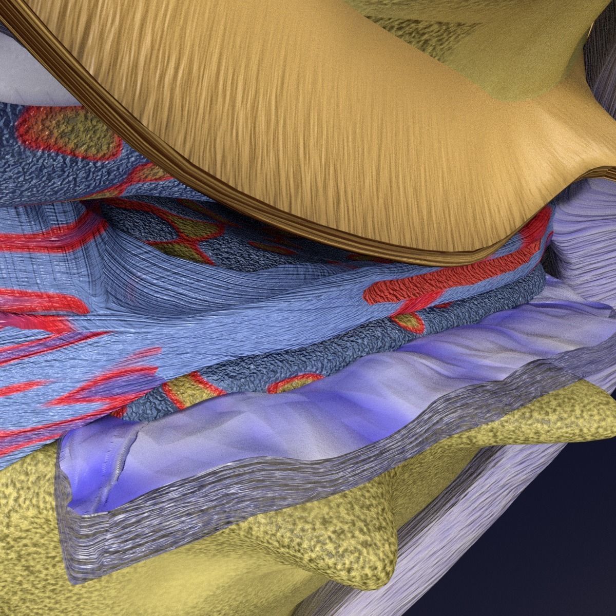 Osteoarthritis stages 3D model_10