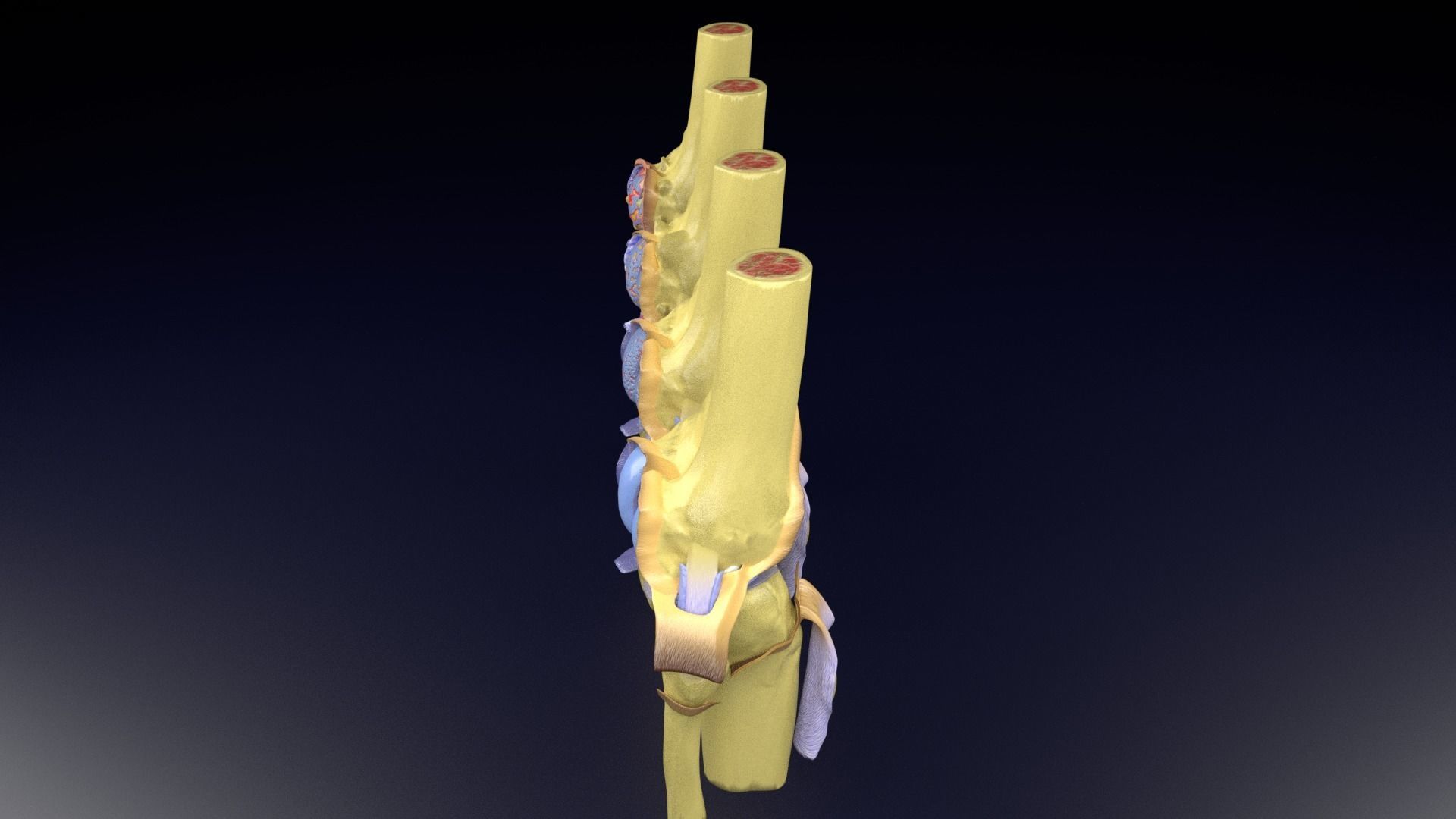 Osteoarthritis stages 3D model_41
