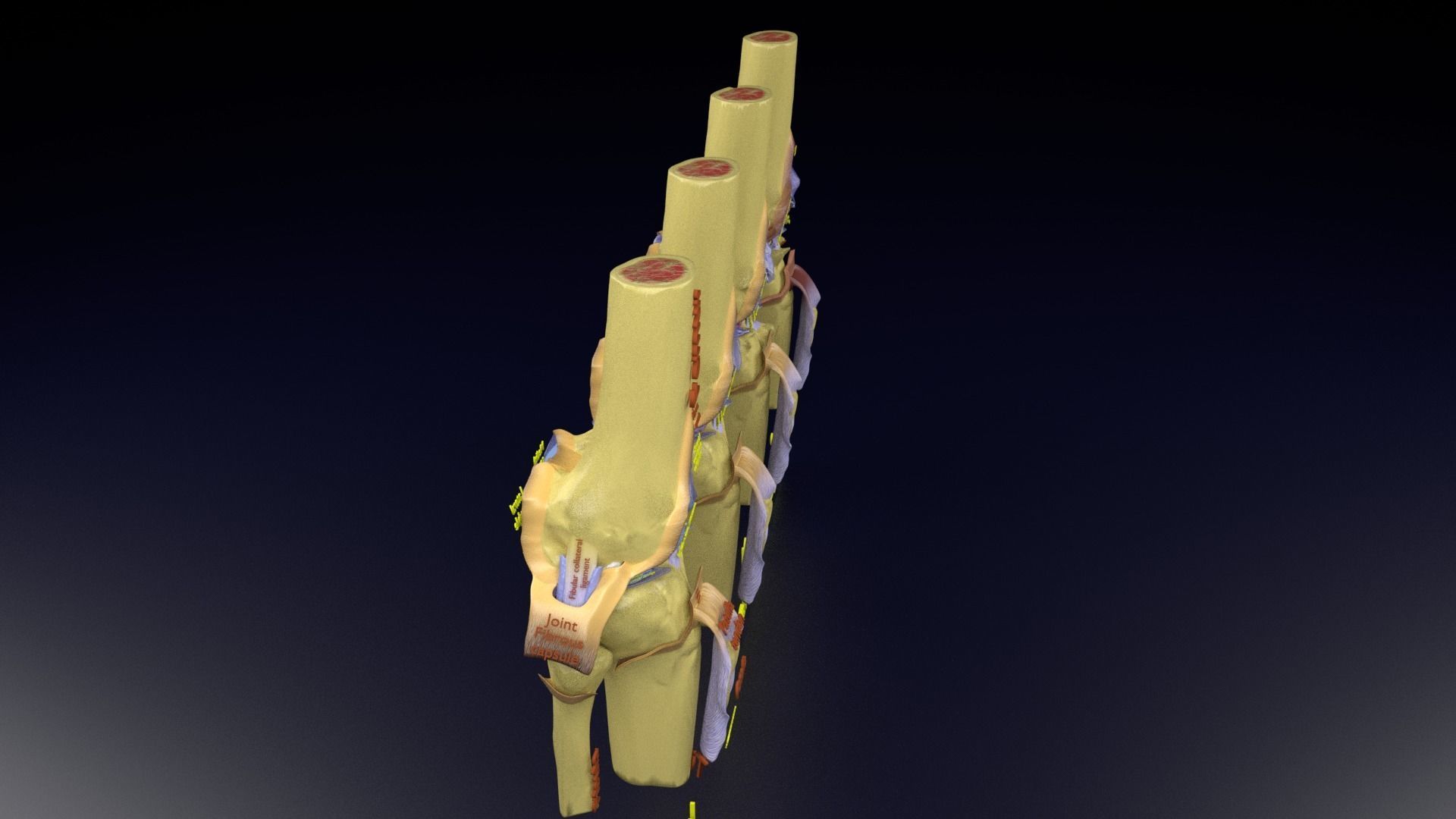 Osteoarthritis stages 3D model_122