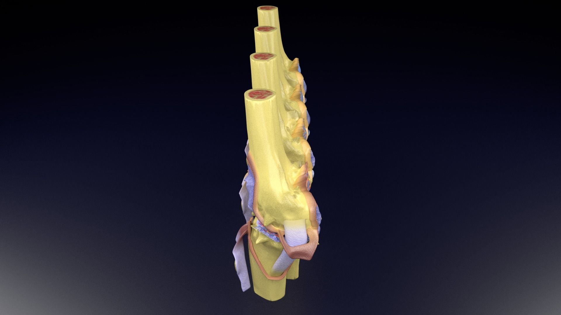 Osteoarthritis stages 3D model_72