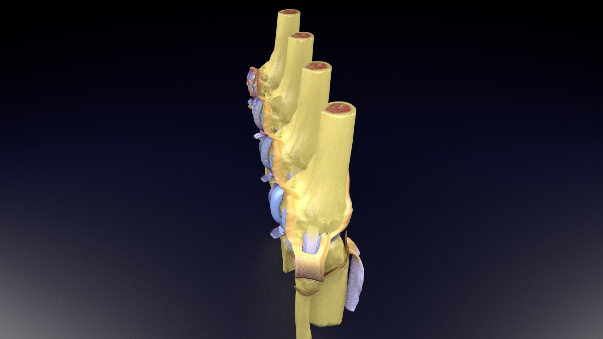 Osteoarthritis stages 3D model_45