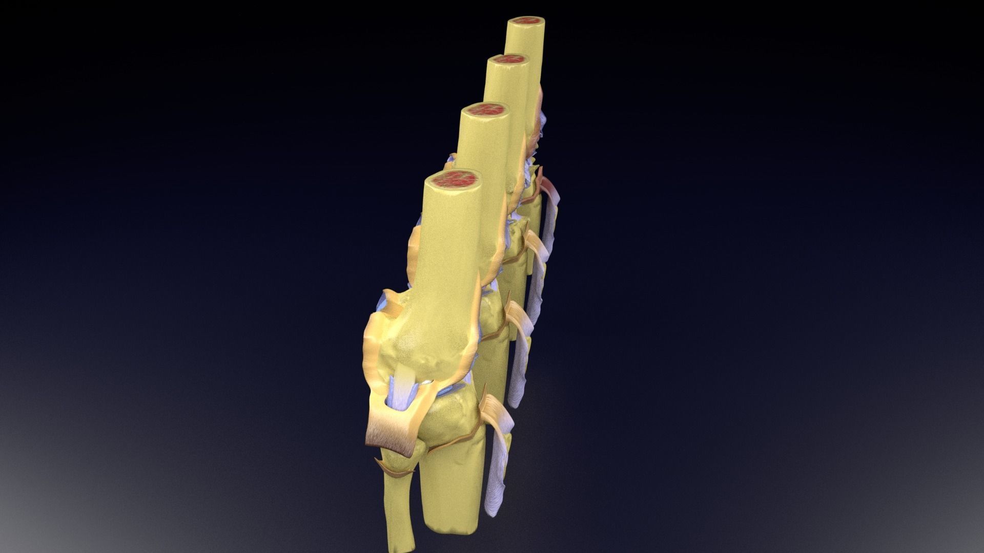 Osteoarthritis stages 3D model_44