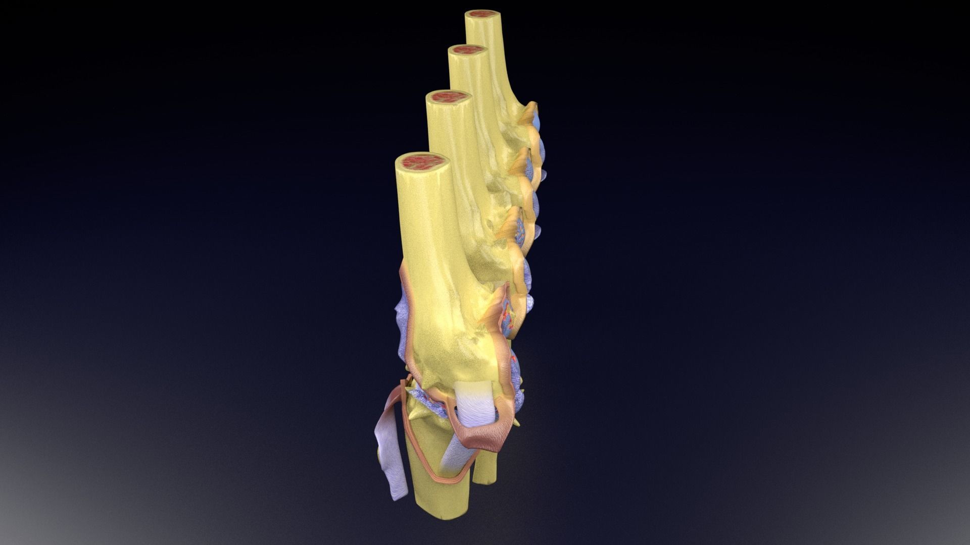 Osteoarthritis stages 3D model_73