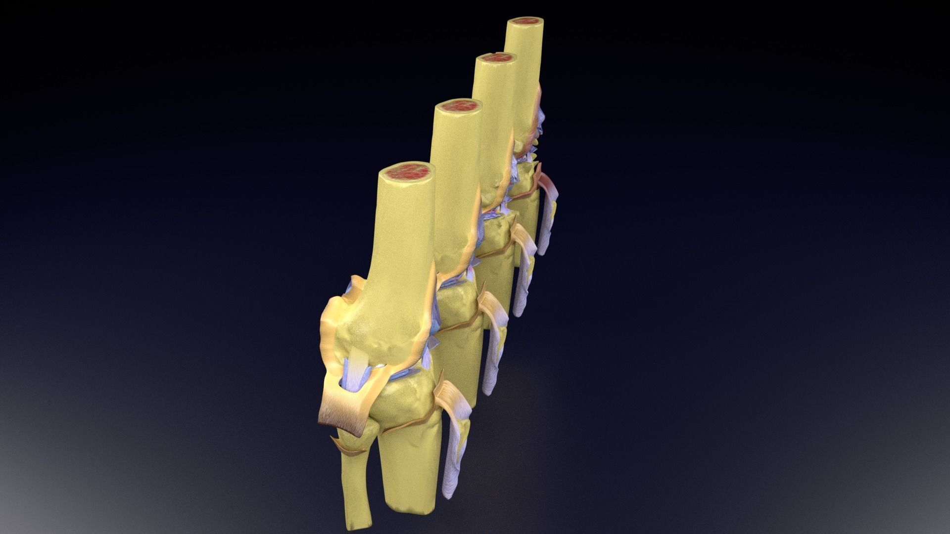 Osteoarthritis stages 3D model_39