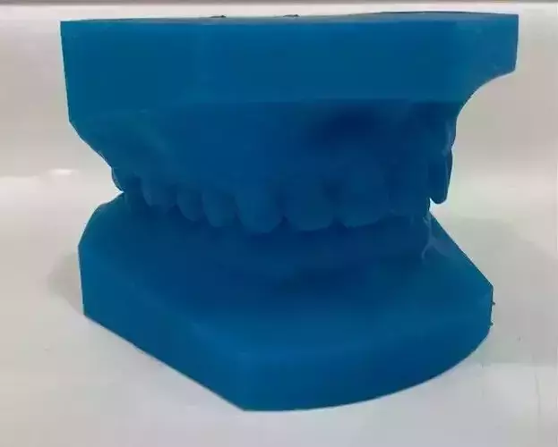 Ortho study model   3D print model