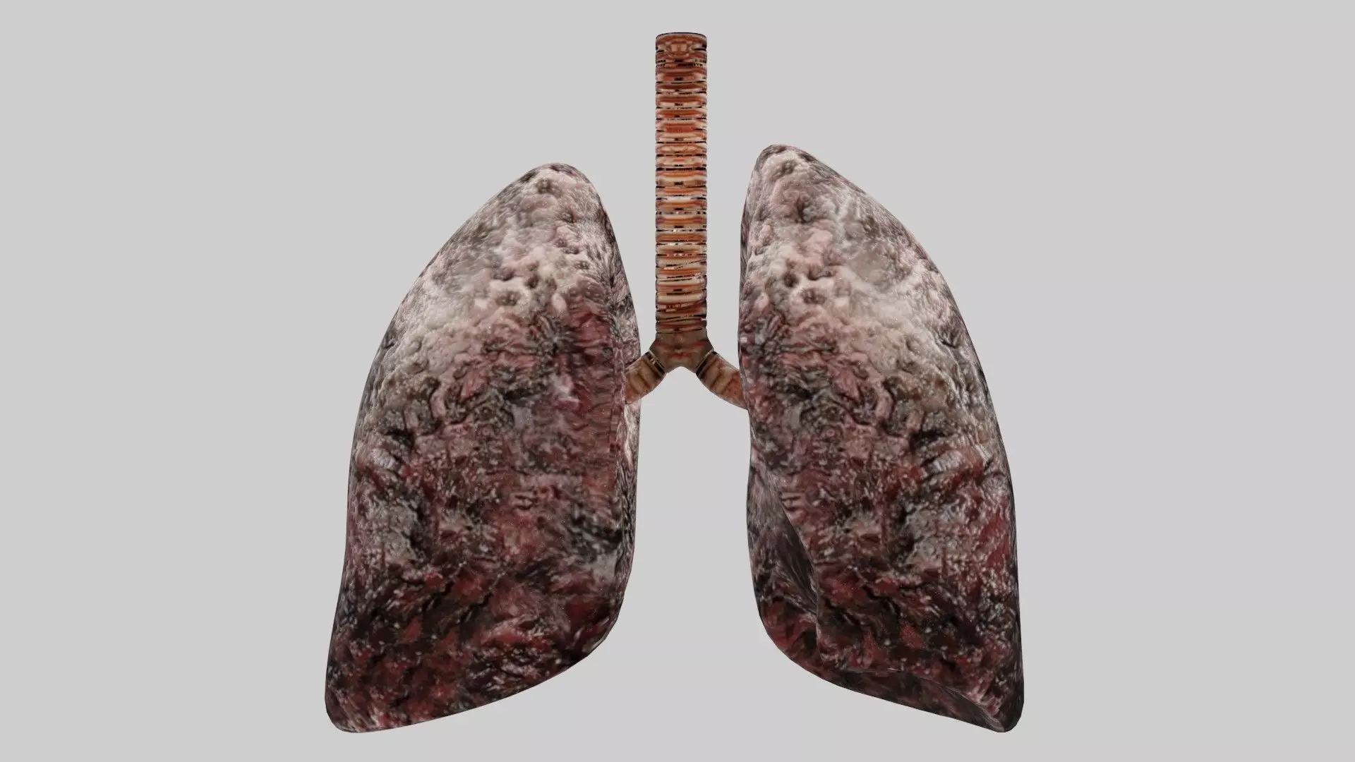 Smoker Human lungs fully rigged low poly 3 Low-poly 3D model_0