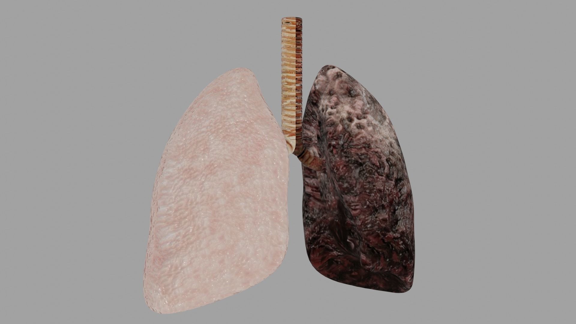 Smoker and non smoker human lungs Low-poly 3D model_1