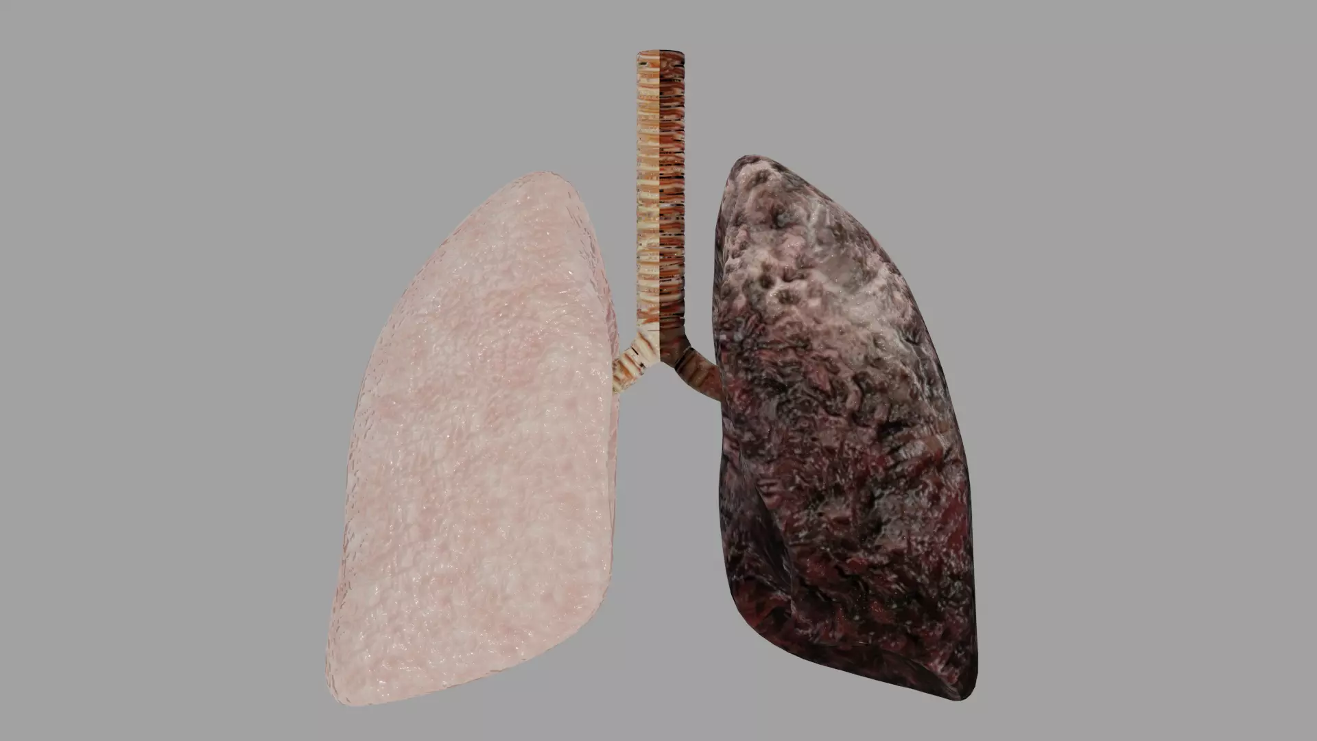 Smoker and non smoker human lungs Low-poly 3D model_0