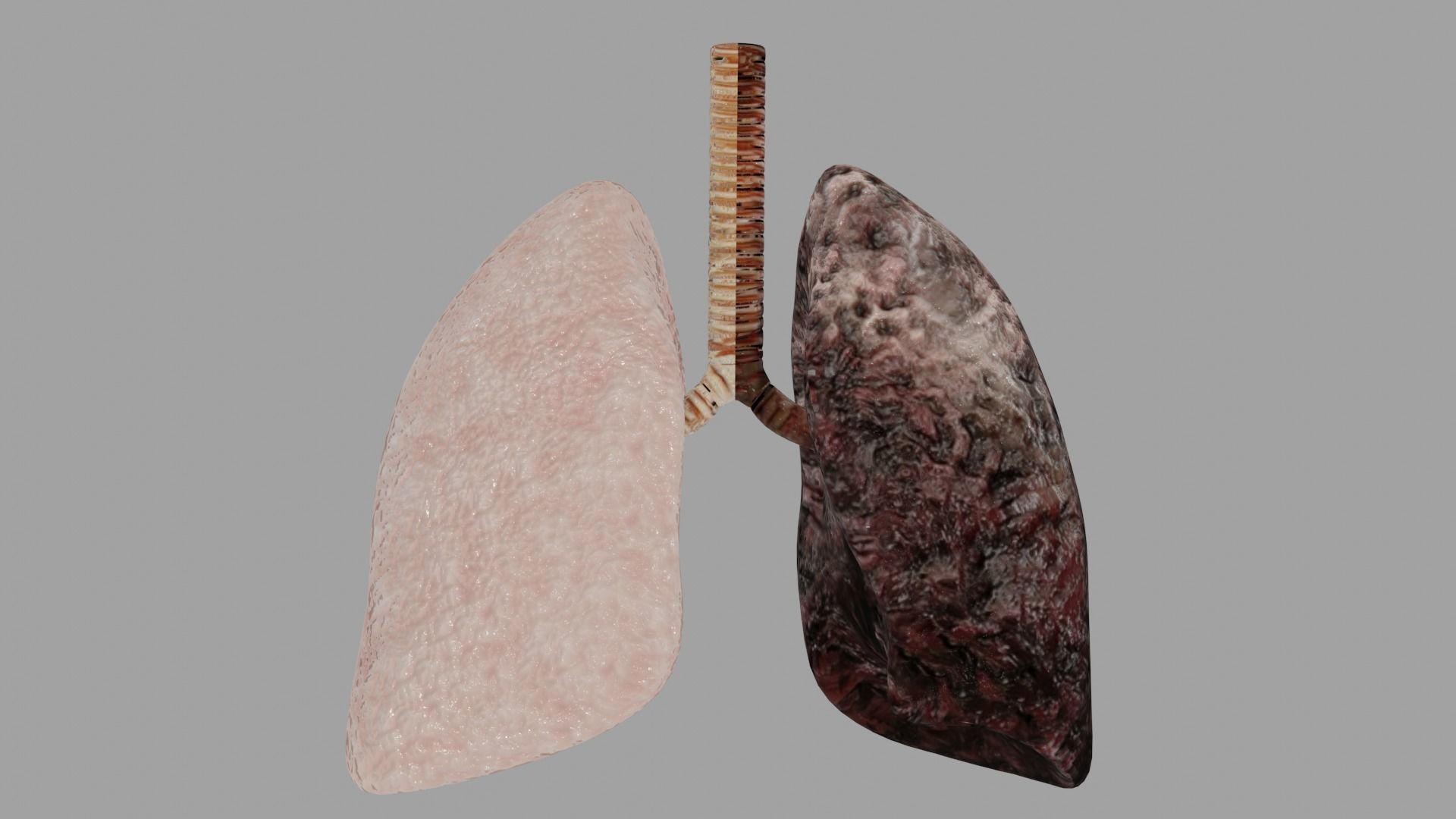 Smoker and non smoker human lungs Low-poly 3D model_5