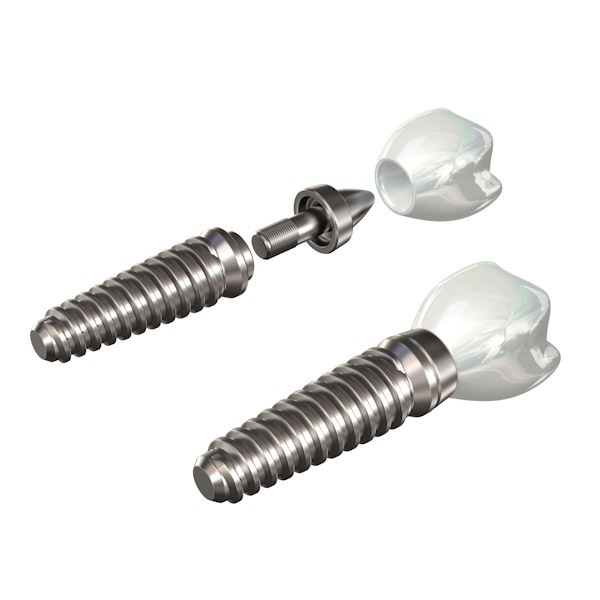 Dental implant 3D model_3