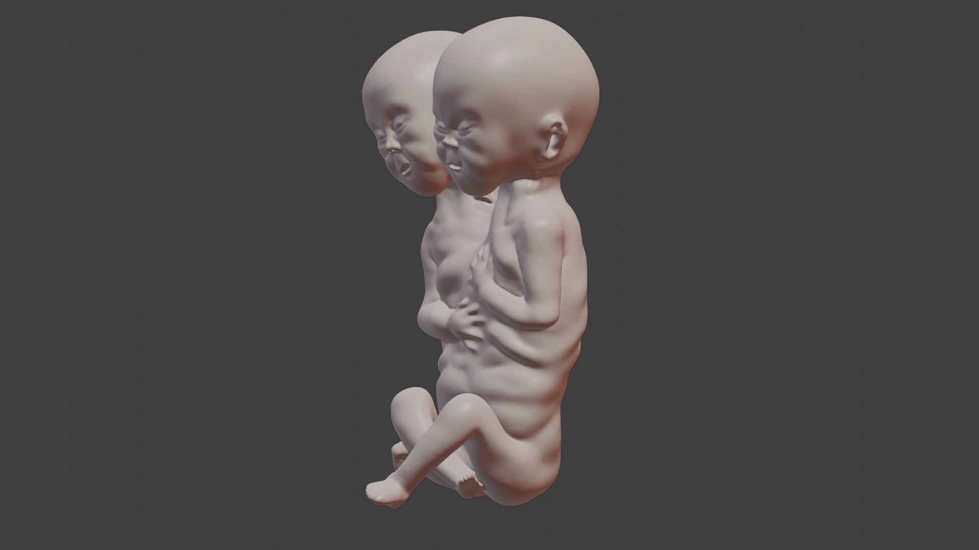 Siamese Twin Fetus 3D print model_3