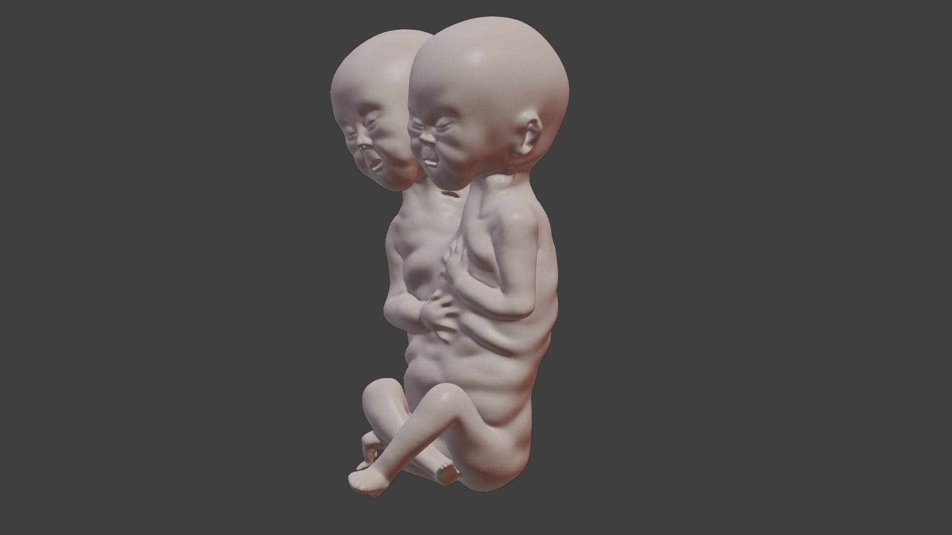 Siamese Twin Fetus 3D print model_5