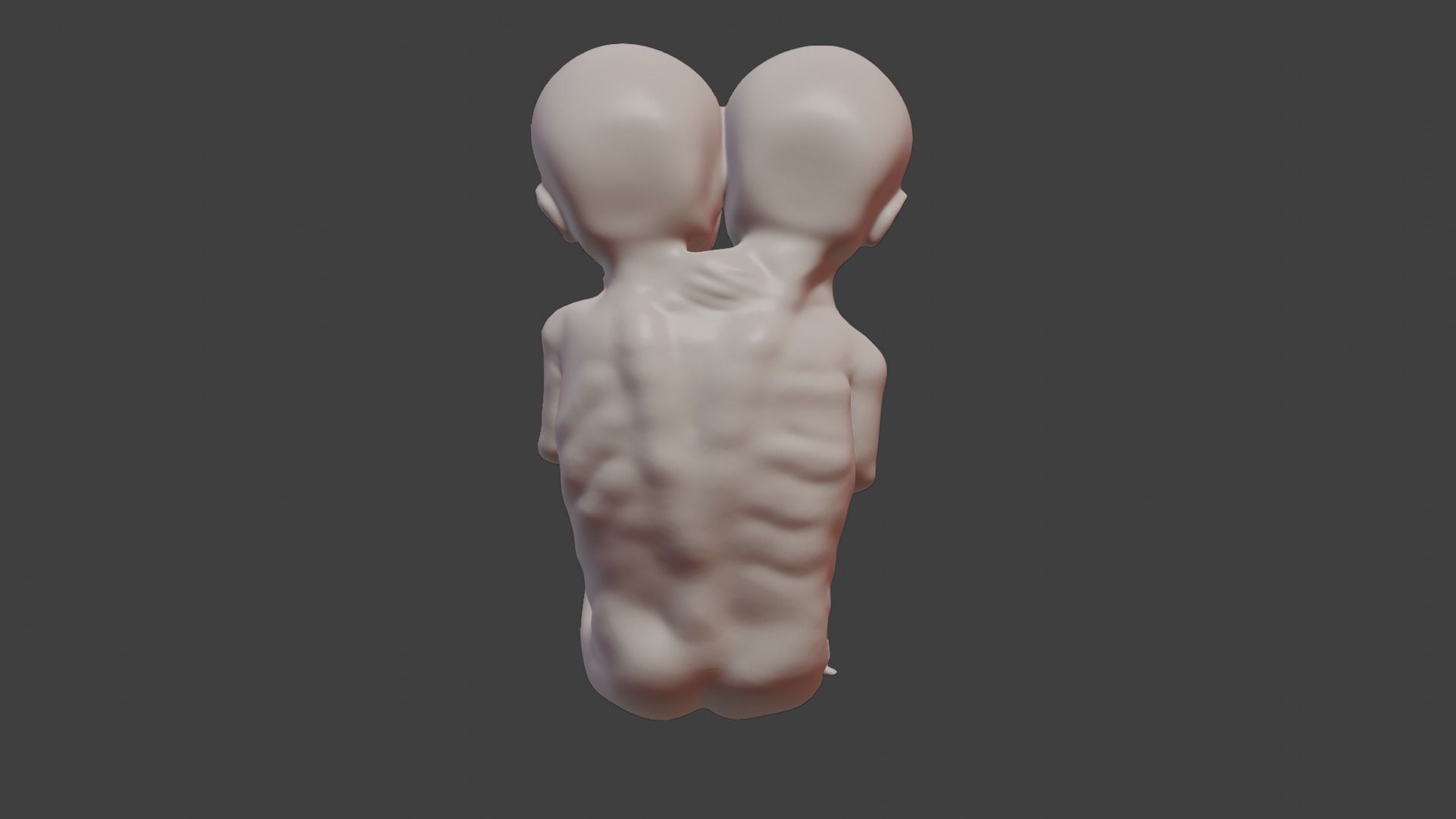 Siamese Twin Fetus 3D print model_2