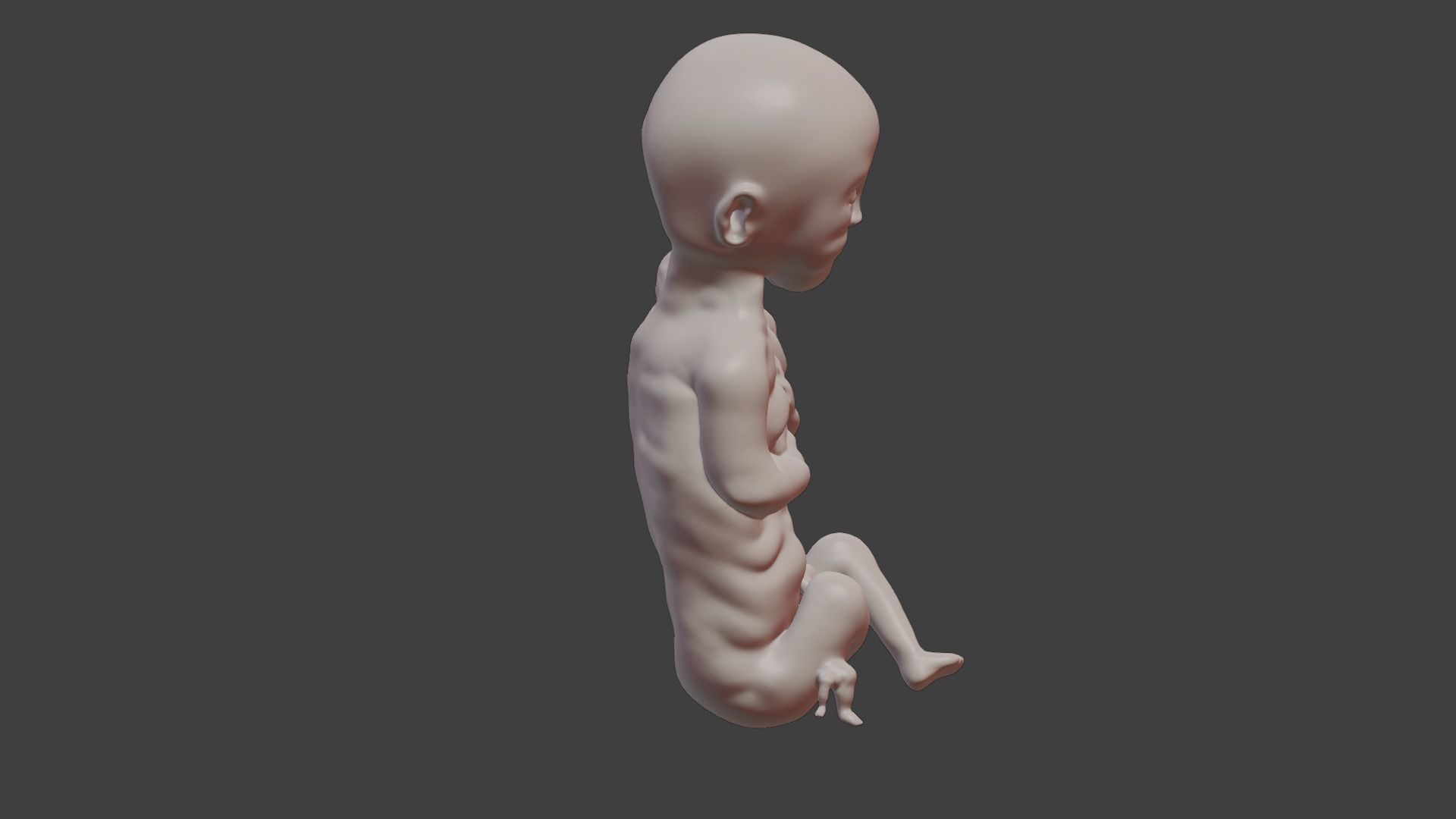 Siamese Twin Fetus 3D print model_6