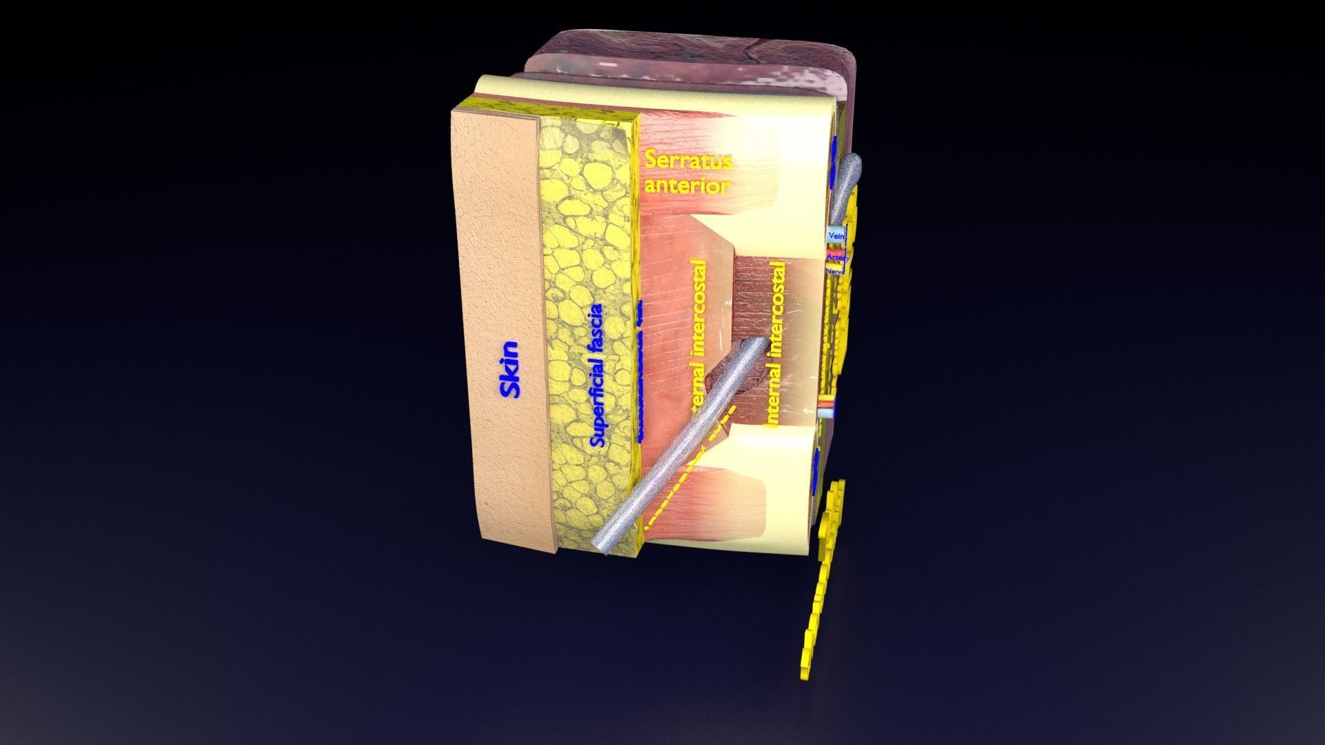 thorax thoracotomy thoracocentesis intercostal nerve block 3D model_54