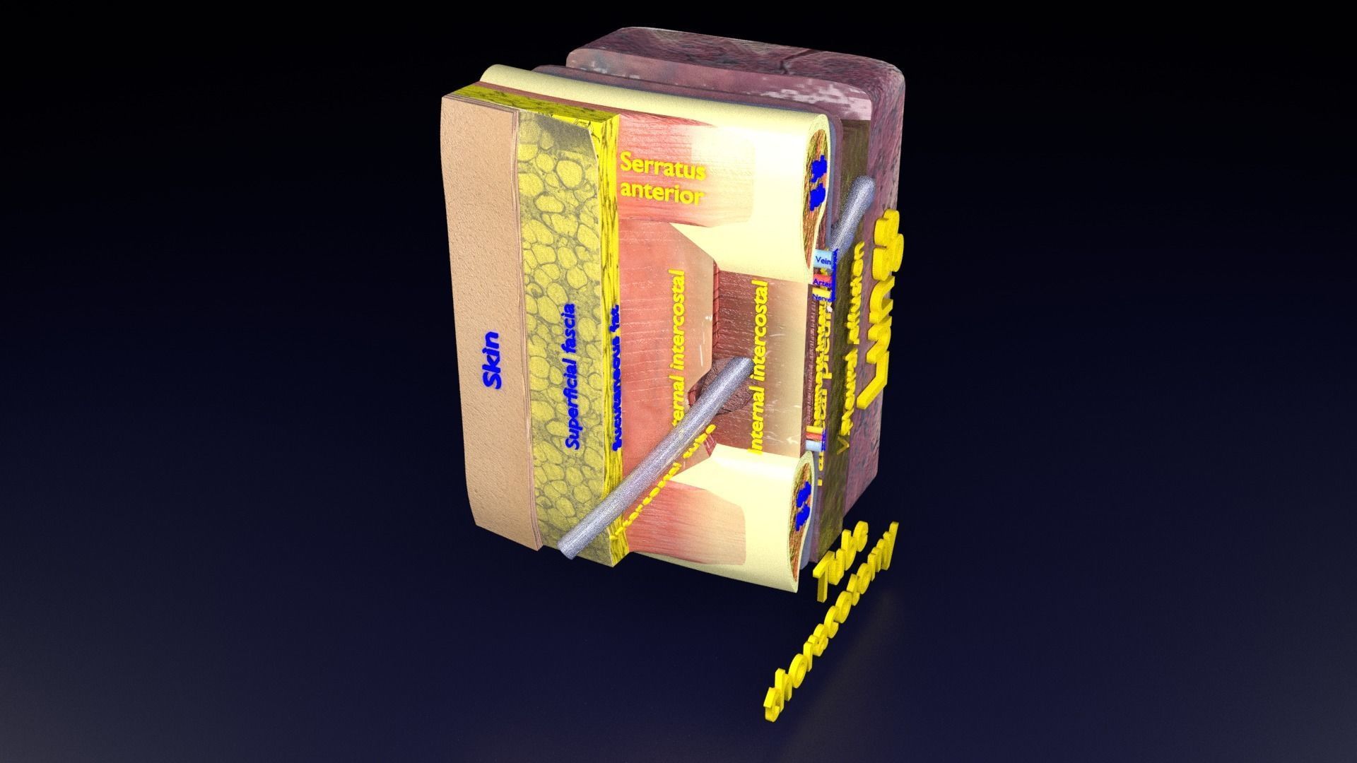thorax thoracotomy thoracocentesis intercostal nerve block 3D model_52