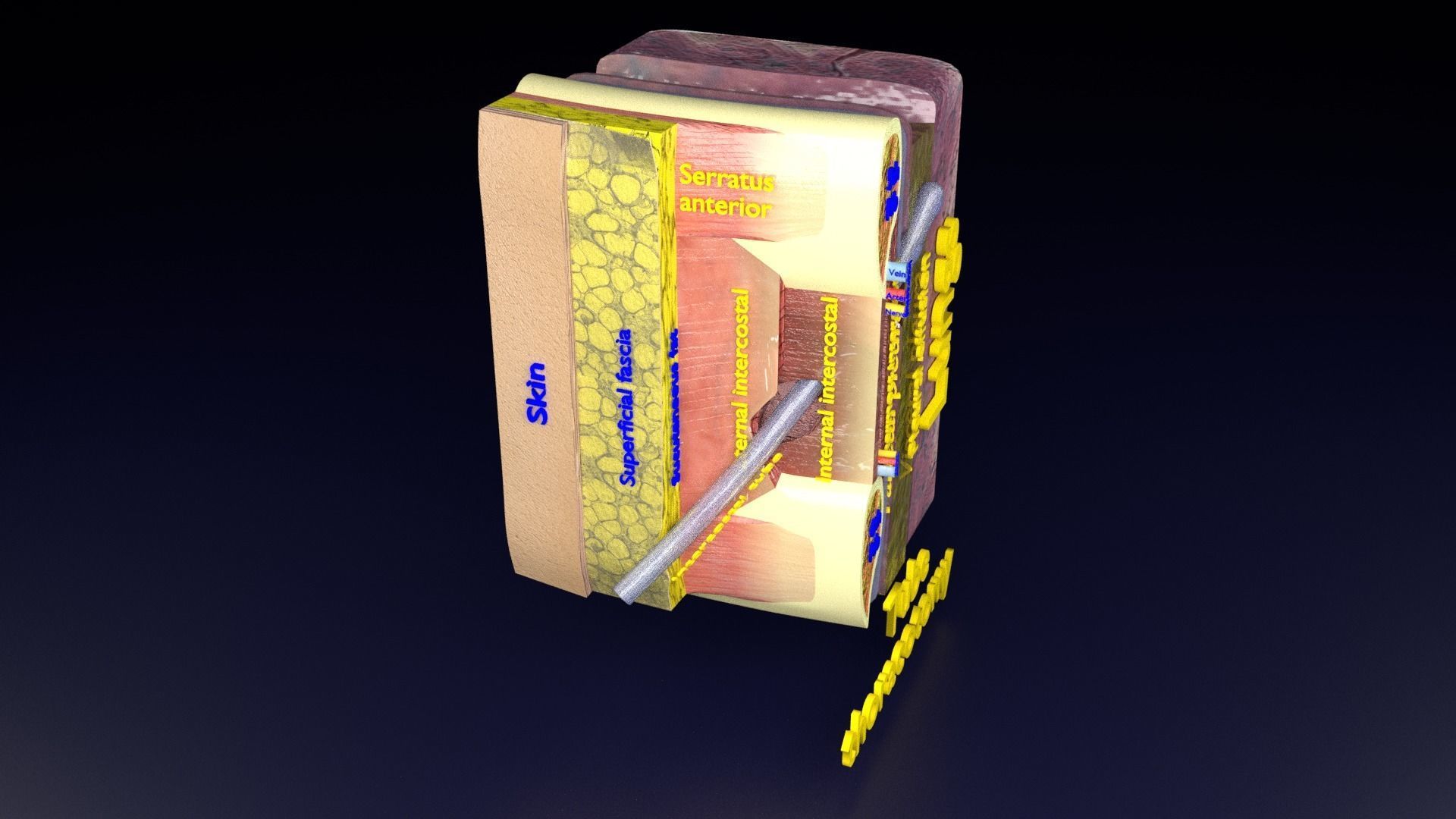 thorax thoracotomy thoracocentesis intercostal nerve block 3D model_53