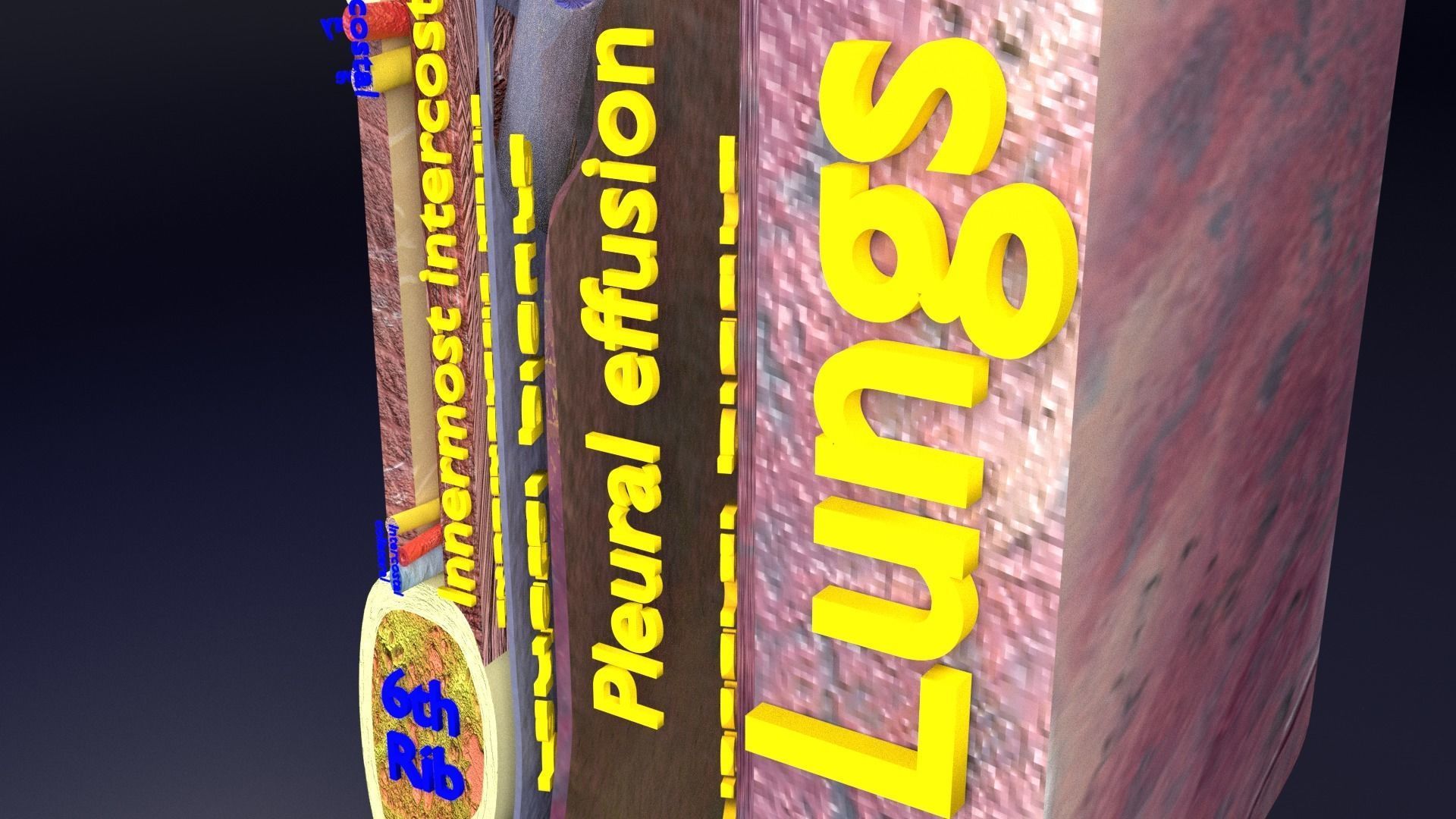 thorax thoracotomy thoracocentesis intercostal nerve block 3D model_34