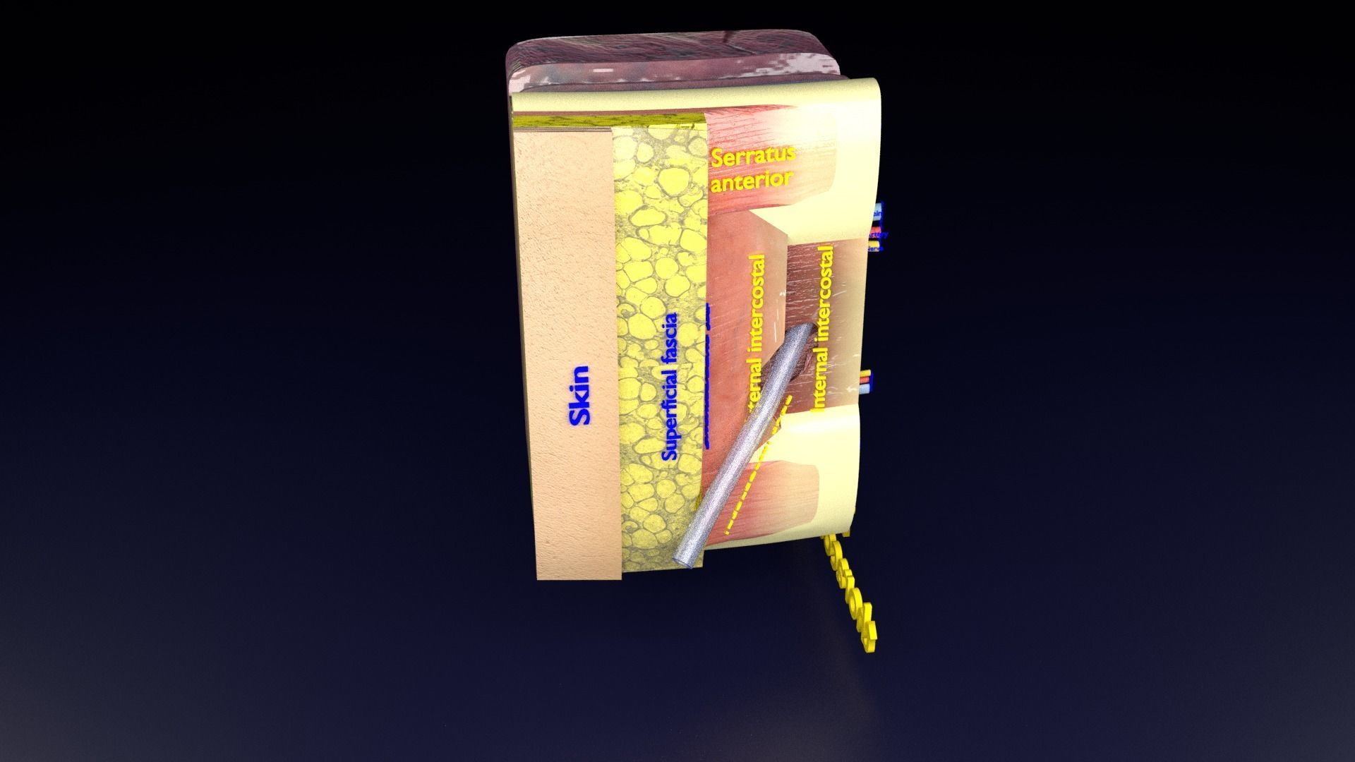 thorax thoracotomy thoracocentesis intercostal nerve block 3D model_41