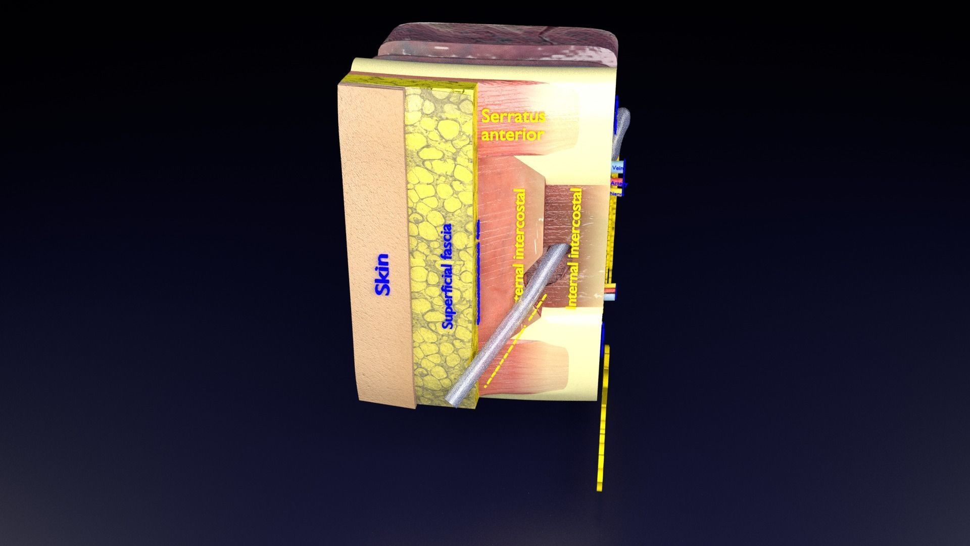 thorax thoracotomy thoracocentesis intercostal nerve block 3D model_58
