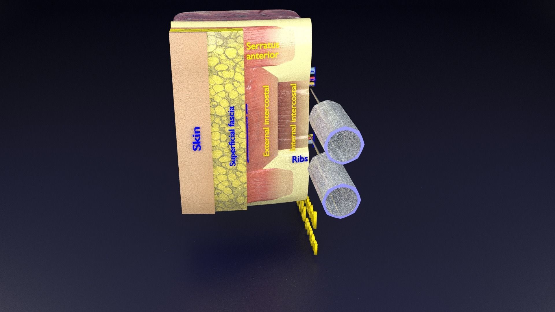 thorax thoracotomy thoracocentesis intercostal nerve block 3D model_95